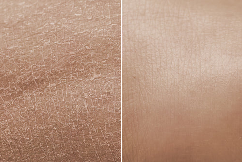 Radiant Skin? Discover Sa Beaute Soap for Dry Skin