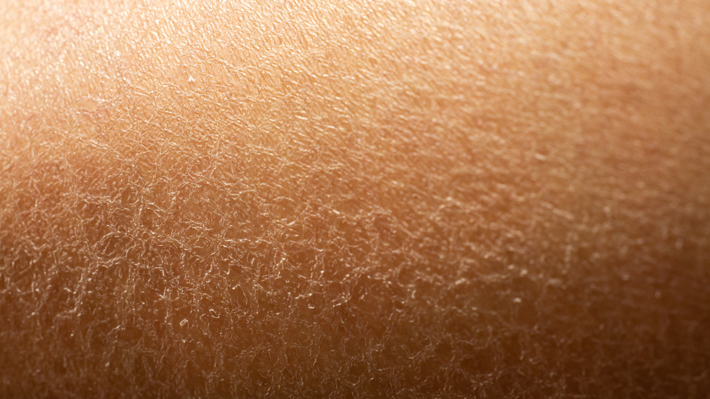 Close up image of a dry flaky skin
